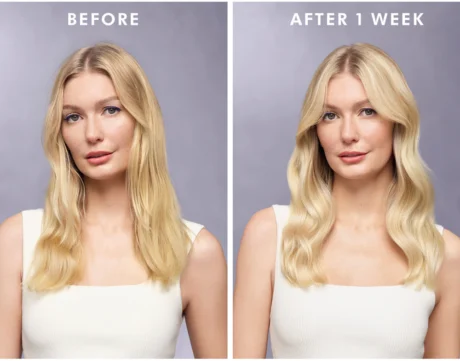 treatment-purple___240620 (2)