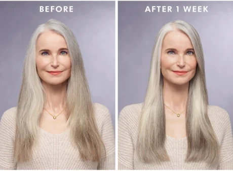 treatment-purple___240620 (3)