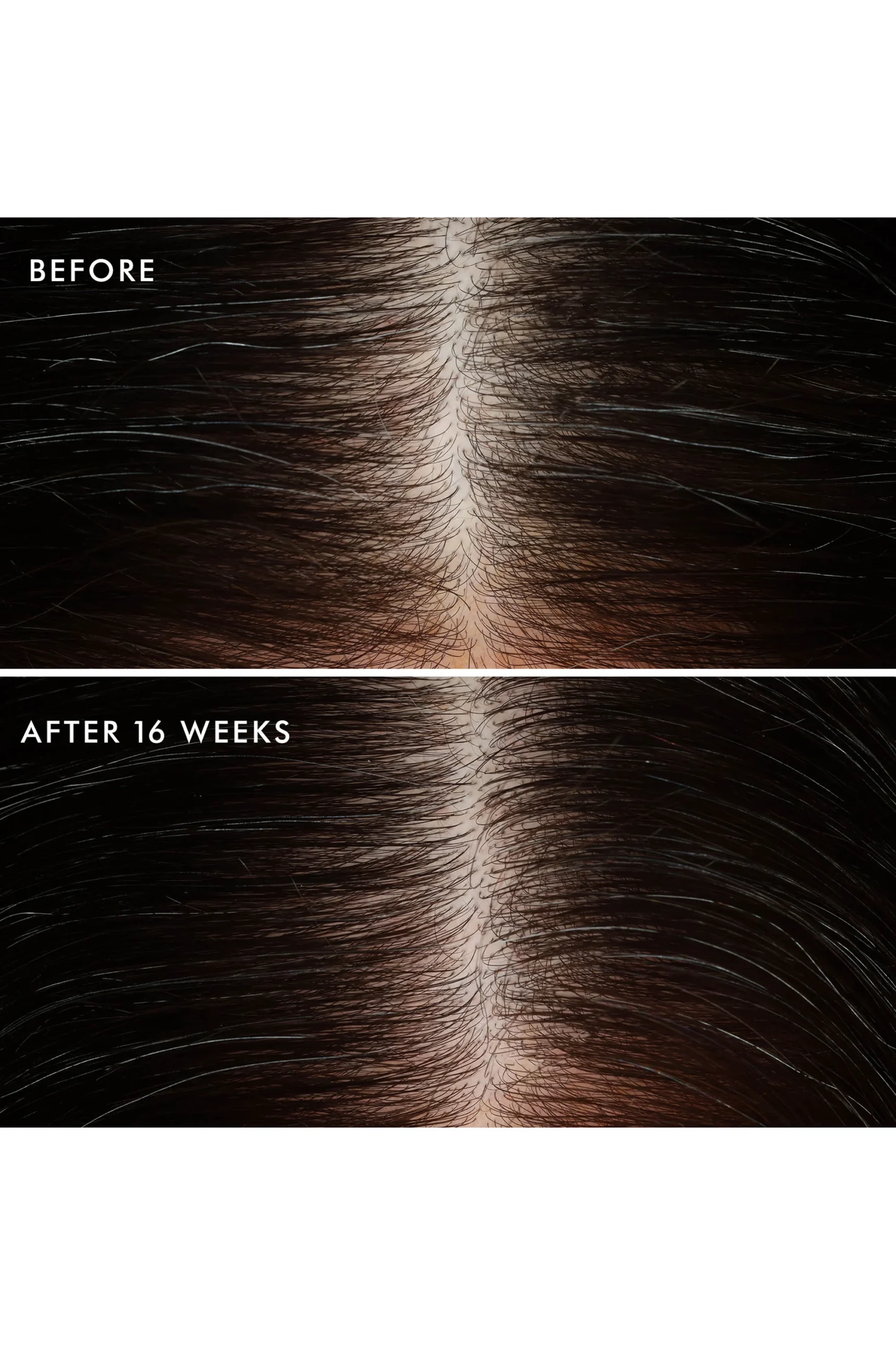 Moroccanoil Scalp Revitalizing Scalp Tonic 100 ml - imagine 4