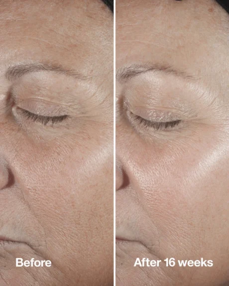 clinique-clinique-smart-clinical-repair-wrinkle-correcting-serum-50ml-192333101681-657545