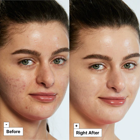 cicapair-tiger-grass-color-correcting-treatment___240412