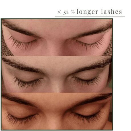 natucain-lash-serum-before-and-after-results