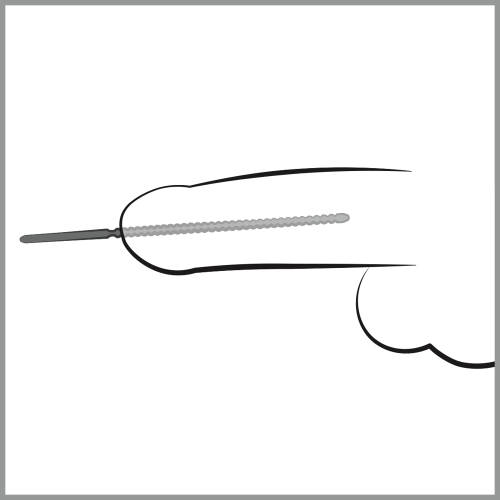 Dip Stick Ripped 6 mm Dilatator Anal din Oțel Inoxidabil 24 cm - imagine 4