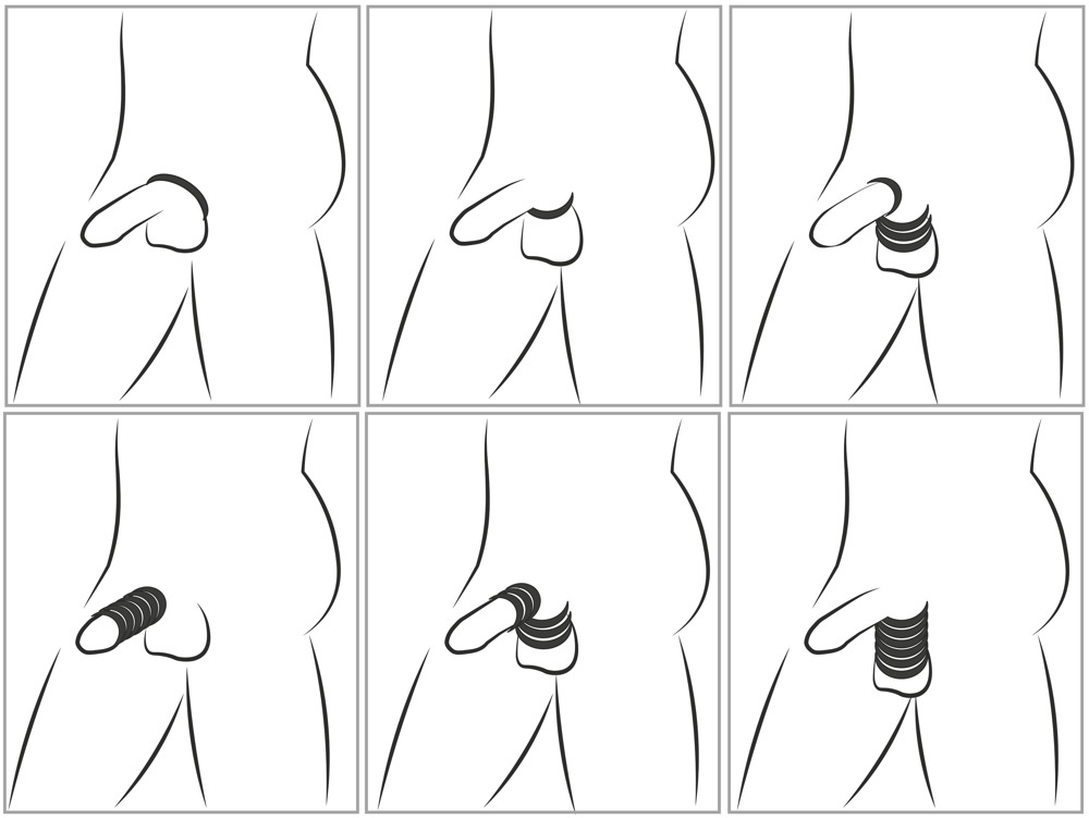 Cock & Ball Stretching Kit You2Toys Set 6 Inele din Silicon - imagine 6